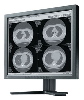 LCD монитор Eizo RadiForce G11 1MP