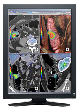 LCD монитор Eizo RadiForce RX210 2MP