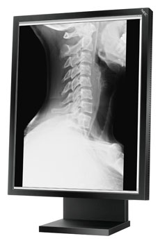 LCD монитор NEC MD21GS-3MP