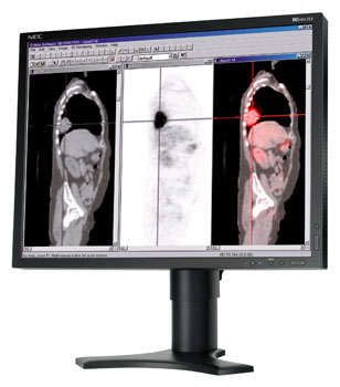 LCD монитор NEC MDview 212