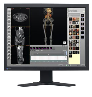 LCD монитор Eizo RadiForce R22 2MP