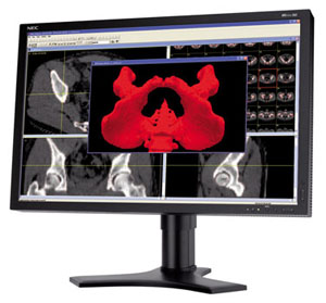 LCD монитор NEC MDview 262