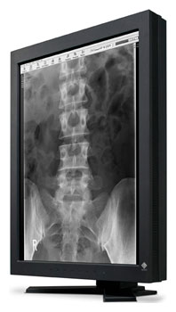 LCD монитор Eizo RadiForce GS220-CLP  2MP mono